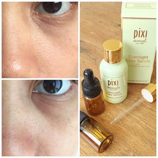 Asli ya gara-gara mbaksis @ini_dhita nih jualan skin care, jadi melek lagi urusan per skin care-an. Selama ini cm pk Hadalabo lotion + FTE SKII aja, dan ga diperhatiin juga tyt bawah mata agak bruntusan. 
Okeh trus ambil jatah preman dari @turiskece Pixi overnight serum ini. Karena menurut blog @deszell bagus. Dan hasilnya emg pas malem pake, paginya kulit jadi kinclong bener. Bruntusan bawah mata agak ilangan (foto bawah). Masalah kemudian timbul pas pake hadalabo lagi kok muncul lagi bruntusannya. Apa mgkn purging 🙄🙄 Jadi PR malam ini, pake pixi serum dan besok hadalabo di stop. 
Trus gara-gara @deszell juga jadi mupeng Sunday riley good genes, tp terus shock liat harganya 🙈🙈🙈 #menujumukakinclong2016